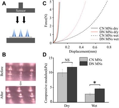 Biodegradable double-network GelMA-ACNM hydrogel microneedles for transdermal drug delivery